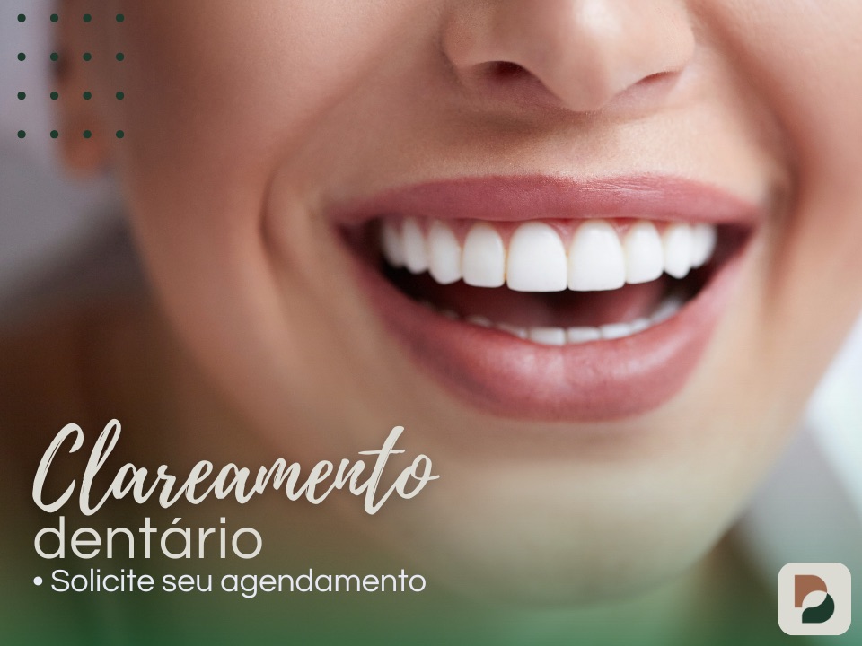 clareamento dentário
