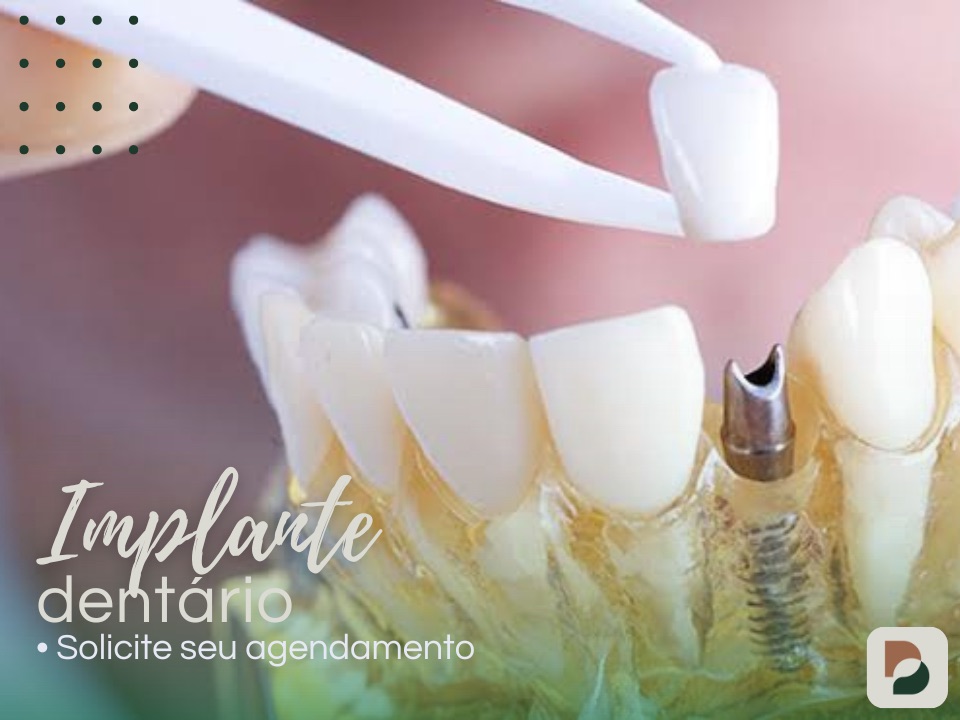 implante dentário
