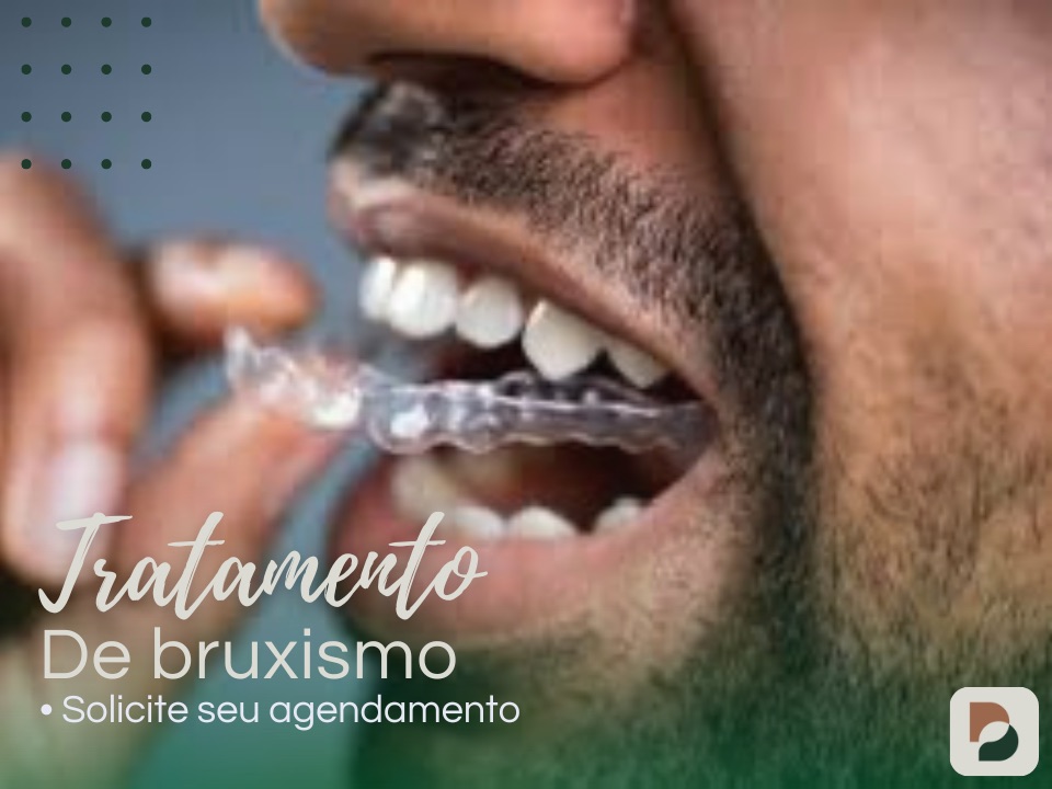 tratamento de bruxismo