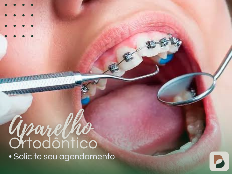 aparelho ortodônticos
